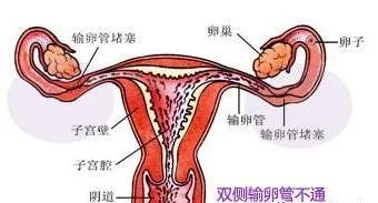 通草的功效与作用能通输卵管堵塞_数据资料解释定义_iso19.42.50.167